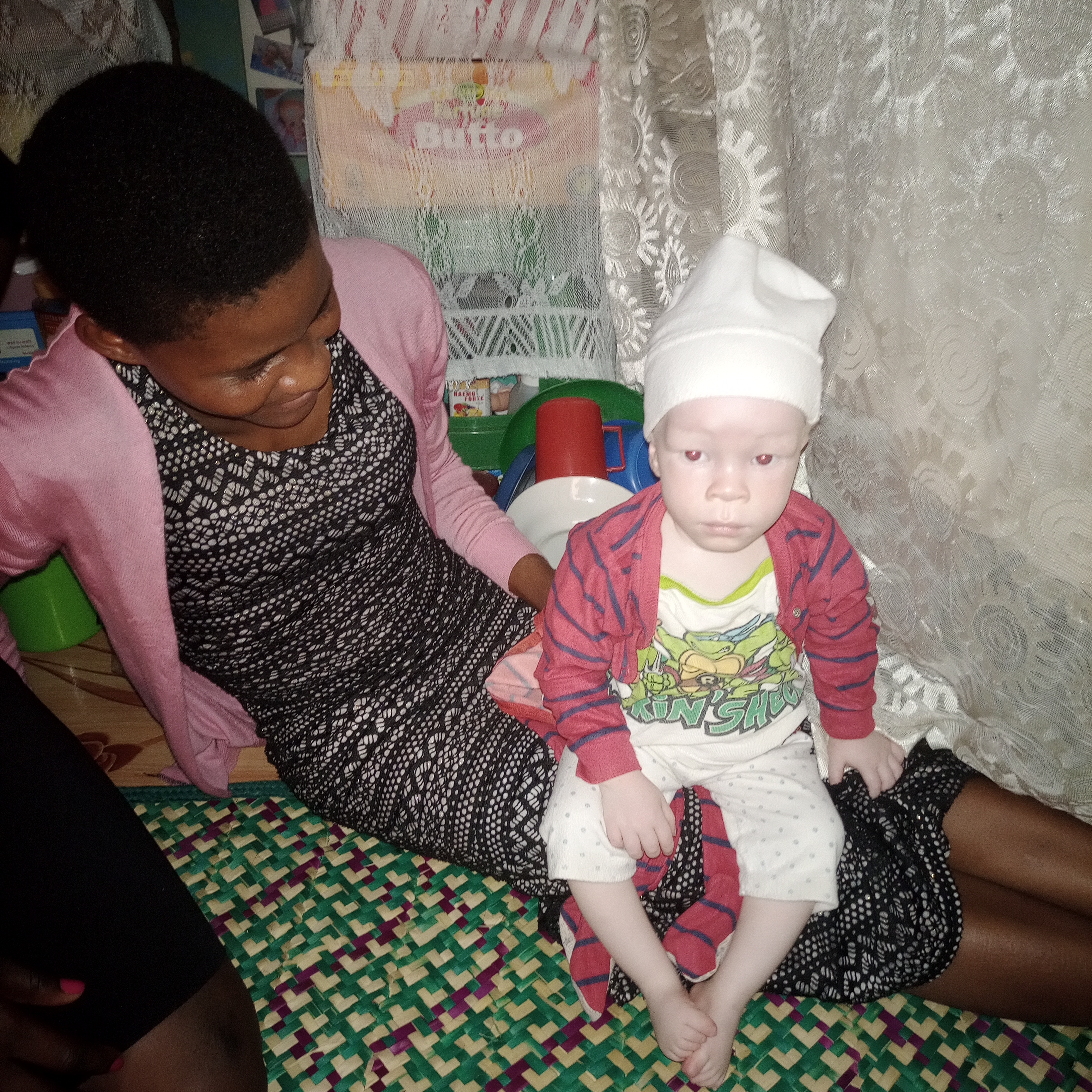 We have our little boy aged 1year & 10 months called Franc. He was abandoned by his father after birth on knowing he was born with a condition of Albinism. Sandra the mother survive on mercies of good Samaritans like you..