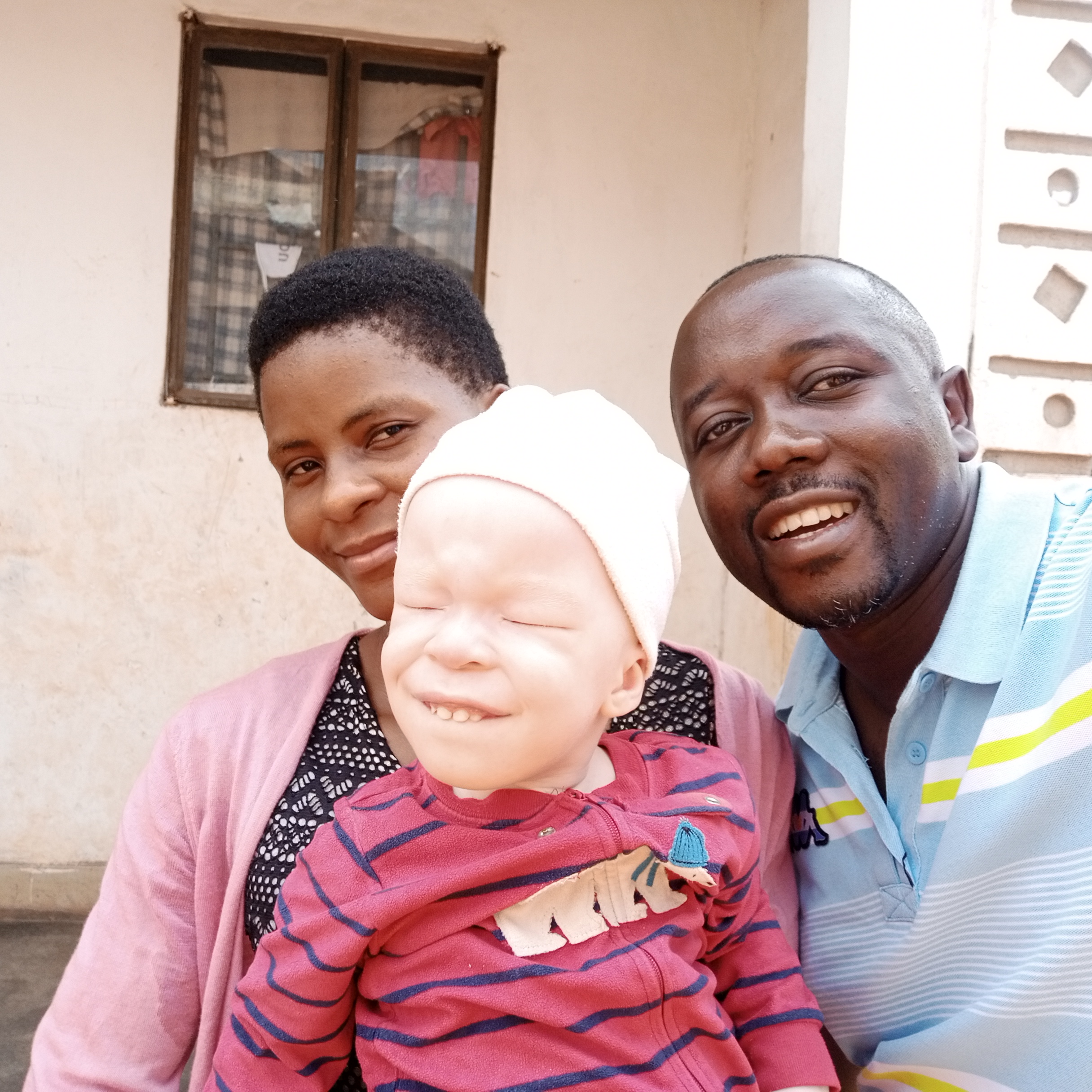  He was abandoned by his father after birth on knowing he was born with a condition of Albinism. Sandra the mother survive on mercies of good Samaritans like you, Albinism is condition where a child is born when lacking melanin, their skin, hair, eyes have low vision, above their skins have high  chances of getting cancer when exposed to sun's ultra violet radiation.